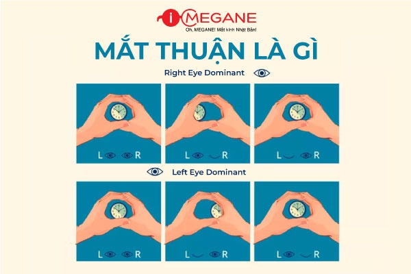 MẮT THUẬN LÀ GÌ?